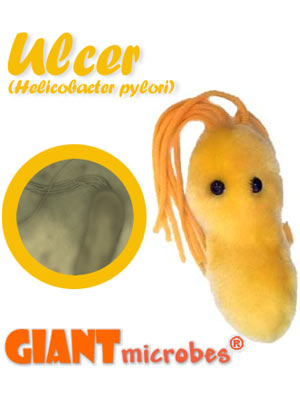Ulcer Giant Microbe