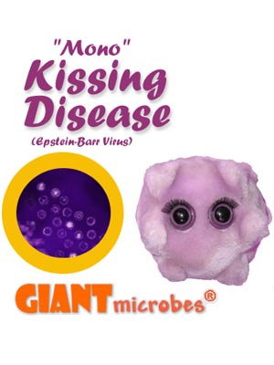 Kissing Disease (Mono / Epstein-Barr Virius) Giant Microbe - #7178958