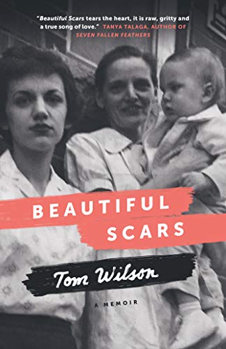 BEAUTIFUL SCARS, by WILSON, TOM