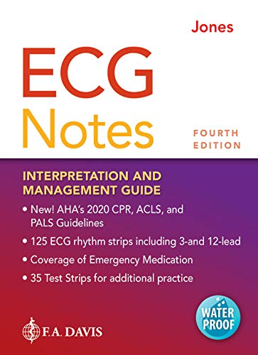 ECG NOTES : INTERPRETATION AND MANAGEMENT GUIDE